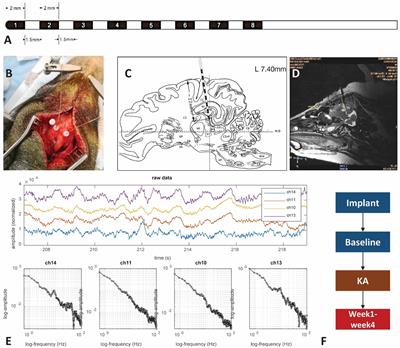 Intracranial electrophysiological recordings on a swine model of mesial temporal lobe epilepsy